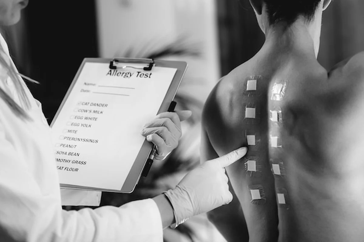 Immunolog robi test alergiczny na kobiecych plecach