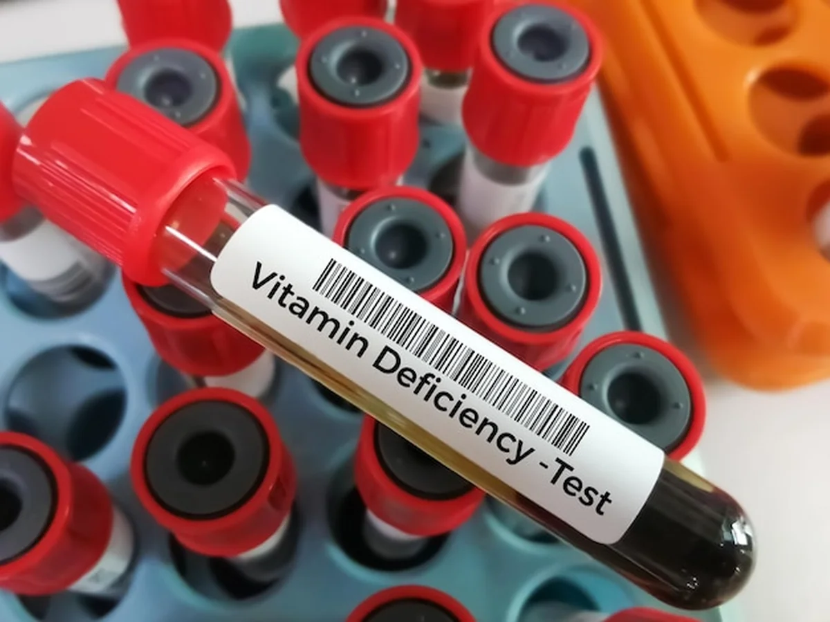 Próbka krwi do testu niedoboru żelaza